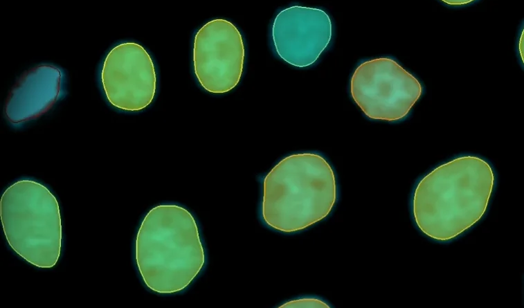 Imaris 11 transforms image analysis